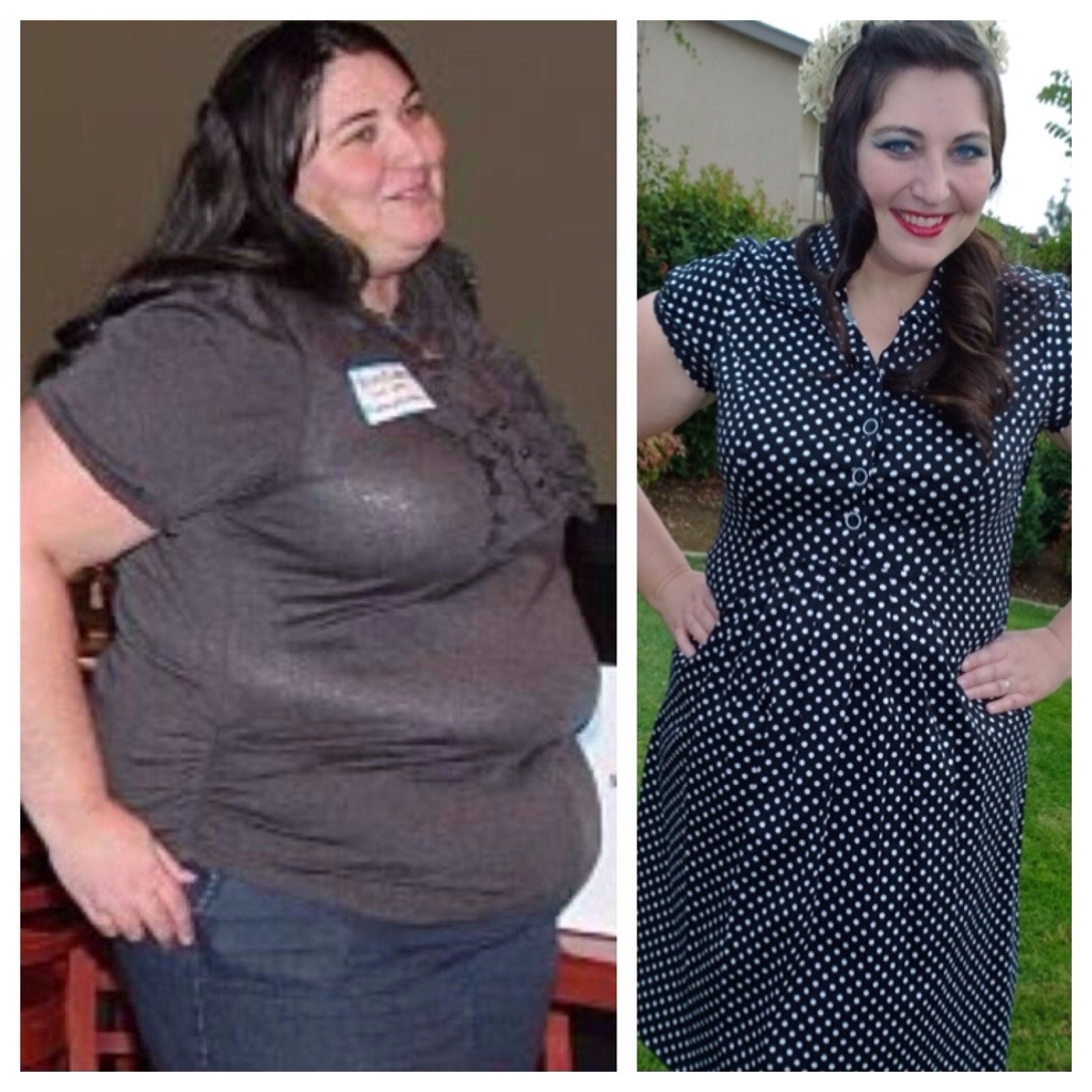 gastric bypass weight loss comparison